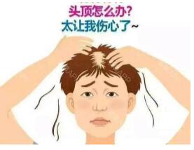 西寧治療脫發(fā)多少錢
